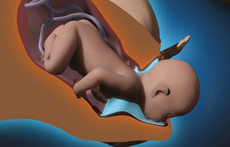 Vaginální porod